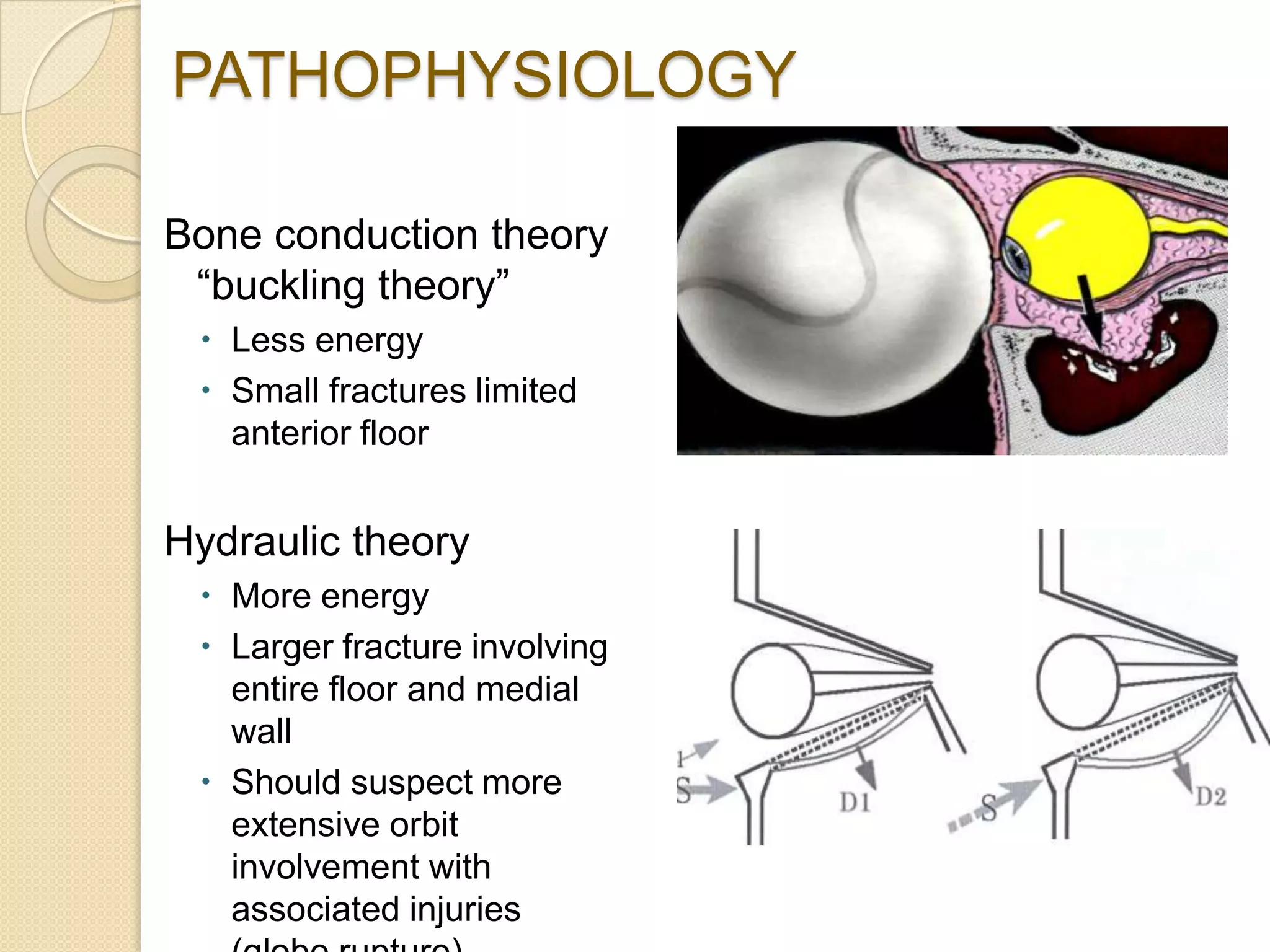 PATHOPHYSIOLOGY
Bone conduction theory
“buckling theory”
 Less energy
 Small fractures limited
anterior floor
Hydraulic theory
 More energy
 Larger fracture involving
entire floor and medial
wall
 Should suspect more
extensive orbit
involvement with
associated injuries
 