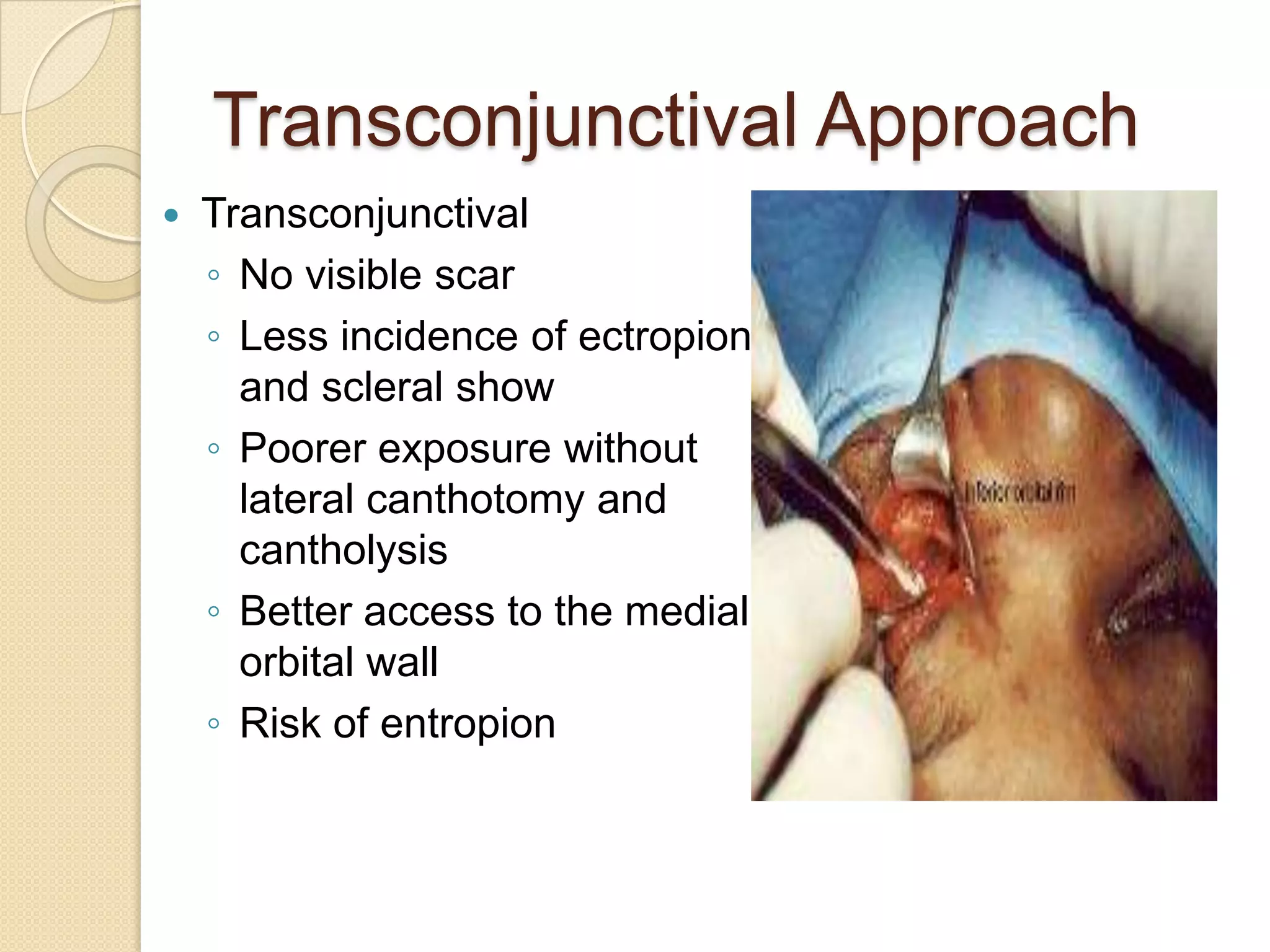 Transconjunctival Approach
 Transconjunctival
◦ No visible scar
◦ Less incidence of ectropion
and scleral show
◦ Poorer exposure without
lateral canthotomy and
cantholysis
◦ Better access to the medial
orbital wall
◦ Risk of entropion
 