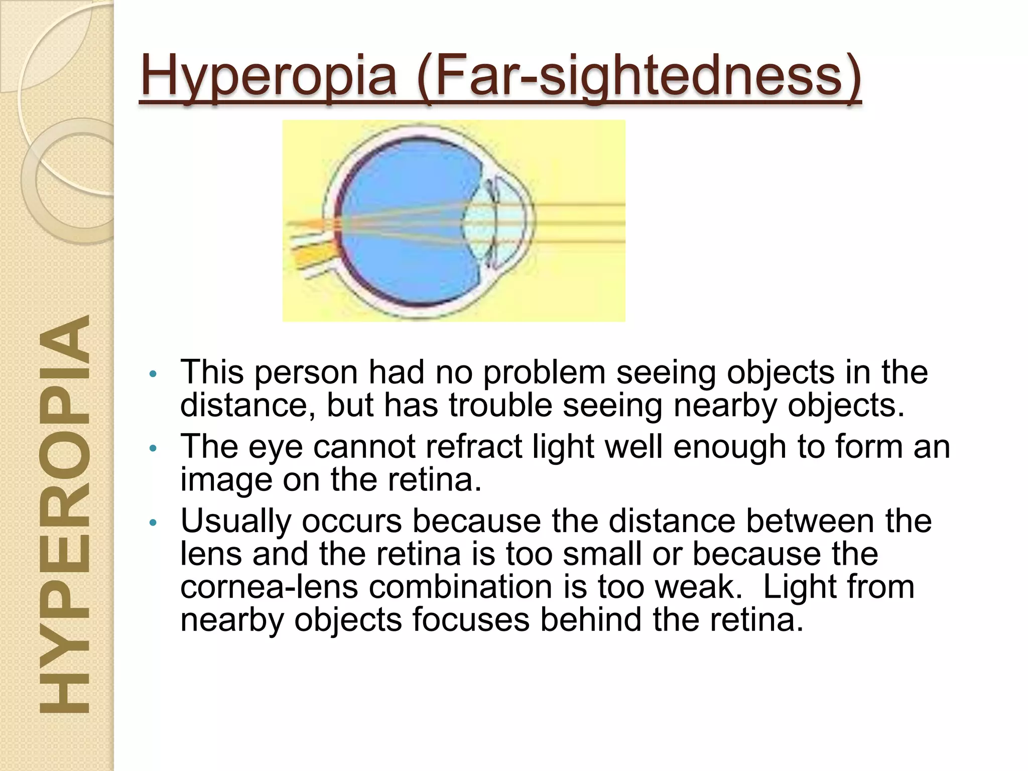 Hyperopia (Far-sightedness)
• This person had no problem seeing objects in the
distance, but has trouble seeing nearby objects.
• The eye cannot refract light well enough to form an
image on the retina.
• Usually occurs because the distance between the
lens and the retina is too small or because the
cornea-lens combination is too weak. Light from
nearby objects focuses behind the retina.
HYPEROPIA
 