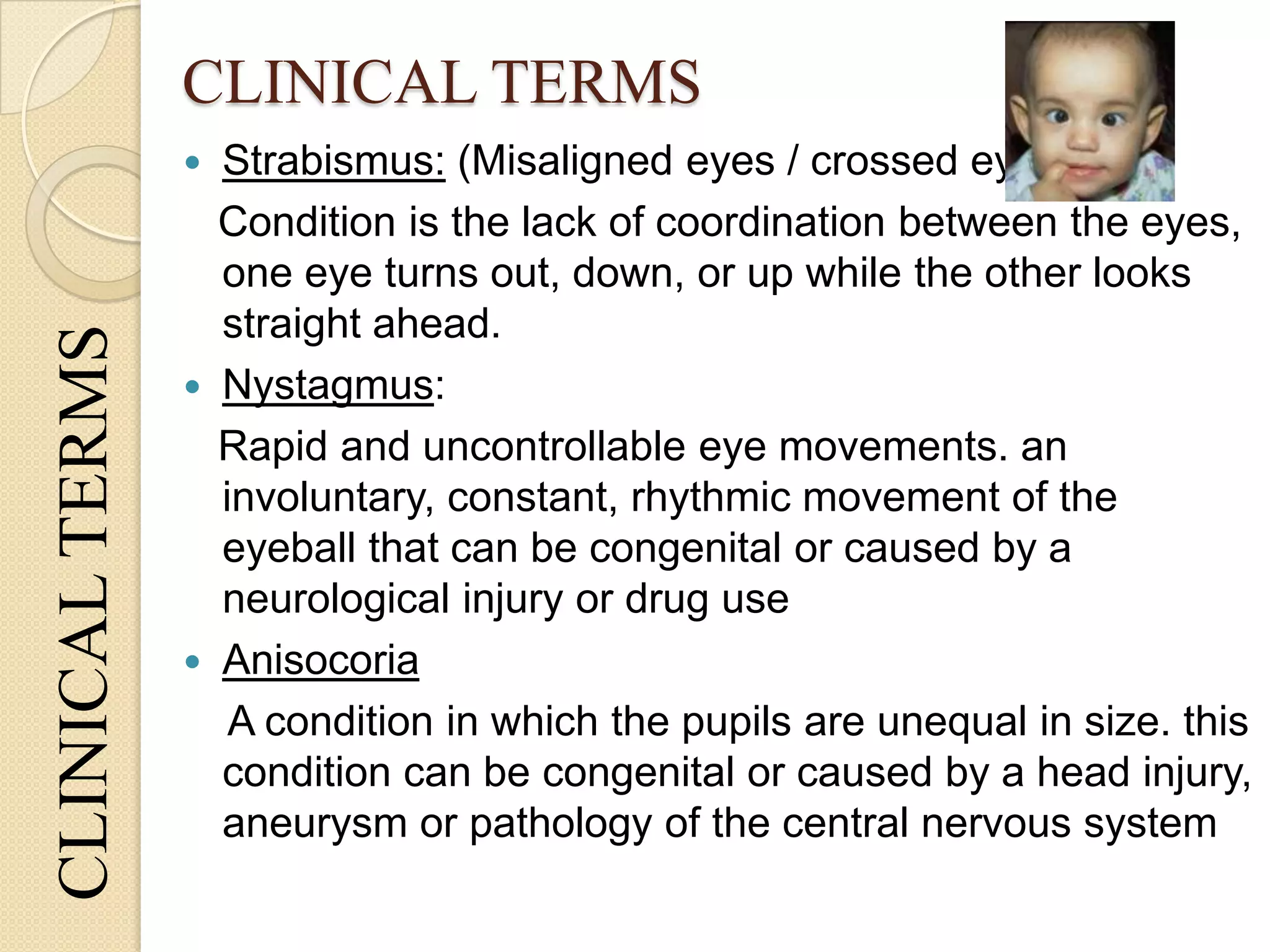 CLINICAL TERMSCLINICALTERMS
 Strabismus: (Misaligned eyes / crossed eye)
Condition is the lack of coordination between the eyes,
one eye turns out, down, or up while the other looks
straight ahead.
 Nystagmus:
Rapid and uncontrollable eye movements. an
involuntary, constant, rhythmic movement of the
eyeball that can be congenital or caused by a
neurological injury or drug use
 Anisocoria
A condition in which the pupils are unequal in size. this
condition can be congenital or caused by a head injury,
aneurysm or pathology of the central nervous system
 