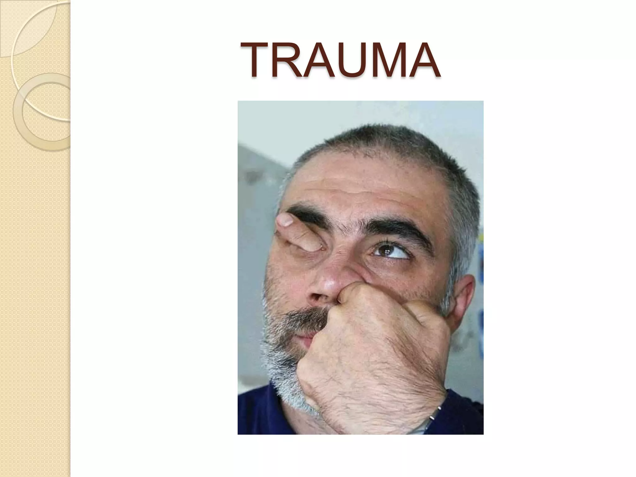 TRAUMA
 