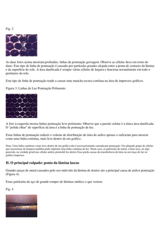 Fig. 2

As duas fotos acima mostram profundas, linhas de pontuação goivagem. Observe as células ileso em torno do
dano. Este tipo de linha de pontuação é causado por partículas grandes alojada entre a ponta de contacto da lâmina
e da superfície do rolo. A área danificada é sempre várias células de largura e funciona normalmente em todo o
perímetro do rolo.
Este tipo de linha de pontuação tende a causar uma mancha escura contínua na área de impressos gráficos.
Figura 3: Linhas de Luz Pontuação Polimento

A foto à esquerda mostra linhas pontuação leve polimento. Observe que a parede celular é a única área danificada.
O "polida olhar" de superfície da área é a linha de pontuação de luz.
Estas linhas de pontuação reduzir o volume de distribuição de tinta do anilox apenas o suficiente para mostrar
como uma linha contínua, mais leve dentro de um gráfico.
Nota: Uma linha contínua e mais leve dentro de um gráfico não é necessariamente causada por pontuação. Um plugado grupo de células
que necessitam de limpeza também pode imprimir uma linha contínua de luz. Neste caso, as partículas de metal, a tinta seca, ou algo
parecido, na verdade grind nas células anilox preenchê-los dentro Essa perda causas da transferência da tinta ou um traço de luz no
gráfico impresso.

II. O principal culpado: ponta da lâmina lascas
Grandes peças de metal causados pelo uso indevido da lâmina de doutor são a principal causa de anilox pontuação
(Figura 4).
Estas partículas de aço de grande romper de lâminas médico o que vestem.
Fig. 4

 