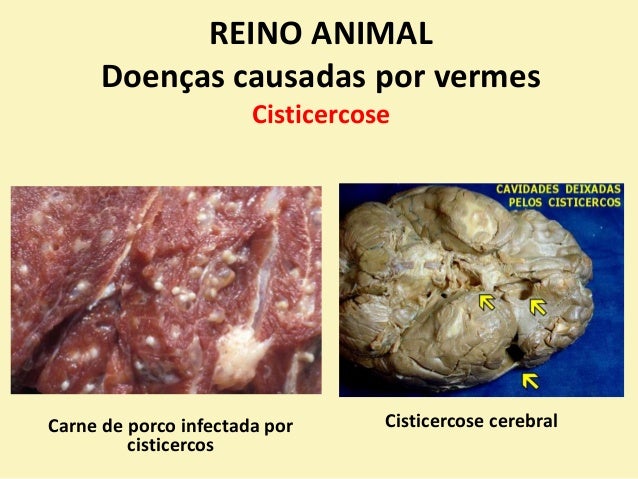 Se os vermes de um gato podem ser transferidos para a pessoa