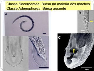 Músculos intestinais: digestão