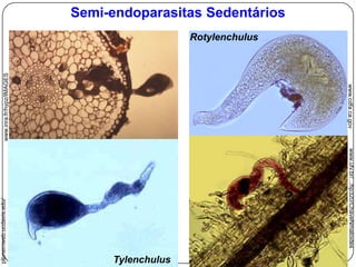 Normalmente na região ventral próximo ao anel nervoso;Anel nervosoPoro da glândula renete (= poro excretor)Células reneteIntestino