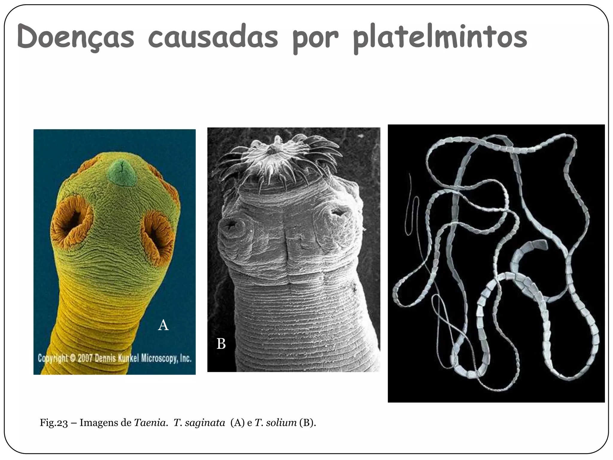Doenças causadas por platelmintos




                          A
                                       B




 Fig.23 – Imagens de Taenia. T. saginata (A) e T. solium (B).
 