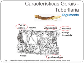 Características Gerais -
                                            Tuberllaria
                                                                                         Tegumento

                     Célula
                     glandul         Vacúolo                 Célula epitelial             Rabiditos
                        ar              s
                                                                                          Espaço
                                                                                          intercelular




                       Núcleo
                                                                   Membrana basal
Fig. 4 – Estrutura da parede do corpo e epiderme de um tuberlário (Modificado de Brusca & Brusca, 2007)
 