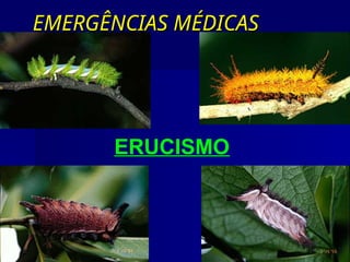 EMERGÊNCIAS MÉDICAS
EMERGÊNCIAS MÉDICAS
ERUCISMO
 