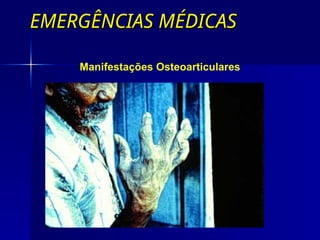 EMERGÊNCIAS MÉDICAS
EMERGÊNCIAS MÉDICAS
Manifestações Osteoarticulares
 
