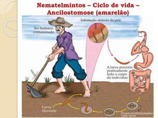 Nematelmintos – Ciclo de vida –
Ancilostomose (amarelão)
 