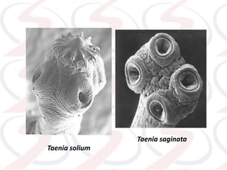 Taenia solium
Taenia saginata
 
