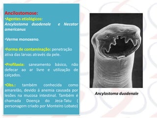 Ancilostomose:
•Agentes etiológicos:
Ancylostoma duodenale e Necator
americanus
•Verme monoxeno.
•Forma de contaminação: penetração
ativa das larvas através da pele.
•Profilaxia: saneamento básico, não
defecar ao ar livre e utilização de
calçados.
•Obs.: também conhecida como
amarelão, devido á anemia causada por
lesões na mucosa intestinal. Também é
chamada Doença do Jeca-Tatu (
personagem criado por Monteiro Lobato)
Ancylostoma duodenale
 