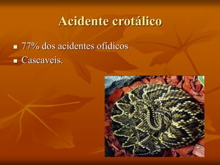 Acidente crotálico
 77% dos acidentes ofídicos
 Cascaveis.
 