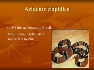 Acidente elapídico
• 0,4% dos acidentes no Brasil.
•Evolui para insuficiência
respiratória aguda.
 
