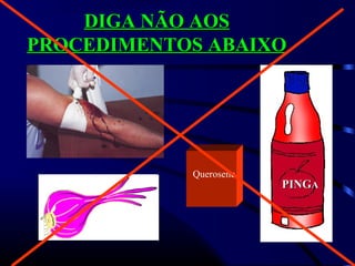 DIGA NÃO AOSDIGA NÃO AOS
PROCEDIMENTOS ABAIXOPROCEDIMENTOS ABAIXO
PINGPINGAA
Querosene
 