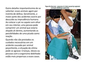Outro detalhe importantíssimo de se
salientar: esses animais agem por
instinto de defesa. Geralmente, a
maior parte dos acidentes ocorre por
descuido ou imprudência humana.
Ao colocar o pé no sapato sem olhar
em seu interior, uma pessoa pode
comprimir um animal que estaria
alojado ali dentro, aumentando as
possibilidades de uma picada como
reação.
Quando não são prestados os
cuidados necessários em um
acidente causado por animal
peçonhento, a situação da vítima
pode se agravar. Crianças, idosos ou
pessoas com o organismo debilitado
estão mais propensas a esses casos.
 