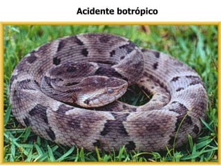 Acidente botrópico
 