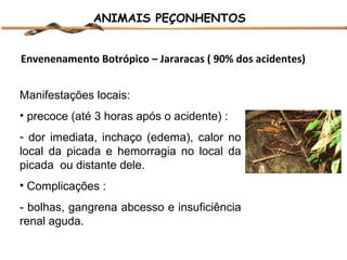 ANIMAIS PEÇONHENTOS
Envenenamento Botrópico – Jararacas ( 90% dos acidentes)
Manifestações locais:
• precoce (até 3 horas após o acidente) :
- dor imediata, inchaço (edema), calor no
local da picada e hemorragia no local da
picada ou distante dele.
• Complicações :
- bolhas, gangrena abcesso e insuficiência
renal aguda.

 