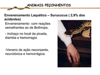 ANIMAIS PEÇONHENTOS
Envenenamento Laquético – Surucucus ( 2,9% dos
acidentes)
Envenenamento com reações
semelhantes ao de Bothrops.
- inchaço no local da picada,
diarréia e hemorragia.
-Veneno de ação necorsante,
neurotóxica e hemorrágica.

 