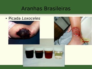 Aranhas Brasileiras
● Picada Loxoceles
 