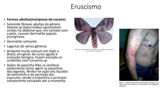 Eruscismo
• Formas adultas(mariposas-da-coceira)
• Somente fêmeas adultas do gênero
Hylesia sp (Saturniidae) apresentam
cerdas no abdome que, em contato com
a pele, causam dermatite papulo
pruriginosa.
• Dermatite urticante
• Lagartas de vários gêneros
• Acidente muito comum em todo o
Brasil, em geral, de curso agudo e
evolução benigna. Fazem exceção os
acidentes com Lonomia sp.
• Ações da peçonha Não se conhece
exatamente como agem as peçonhas
das lagartas. Atribui-se ação aos líquidos
da hemolinfa e da secreção das
espículas, tendo a histamina o principal
componente estudado até o momento.
 