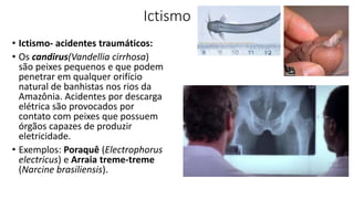 Ictismo
• Ictismo- acidentes traumáticos:
• Os candirus(Vandellia cirrhosa)
são peixes pequenos e que podem
penetrar em qualquer orifício
natural de banhistas nos rios da
Amazônia. Acidentes por descarga
elétrica são provocados por
contato com peixes que possuem
órgãos capazes de produzir
eletricidade.
• Exemplos: Poraquê (Electrophorus
electricus) e Arraia treme-treme
(Narcine brasiliensis).
 