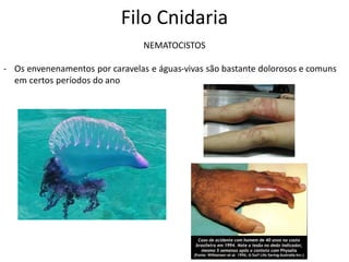 Filo Cnidaria
NEMATOCISTOS
- Os envenenamentos por caravelas e águas-vivas são bastante dolorosos e comuns
em certos períodos do ano
 