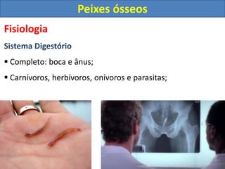Fisiologia
Sistema Digestório
 Completo: boca e ânus;
 Carnívoros, herbívoros, onívoros e parasitas;
Peixes ósseos
 