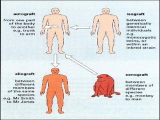 Isograft Examples TRANSPLANTATION AND DONOR TYPES | PPT