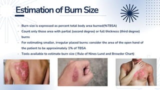 Animal-bites-Tetanus-Burn-Injuries.pptx