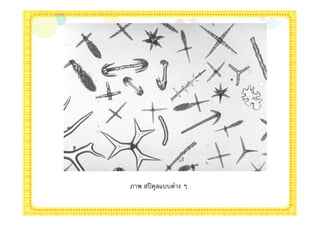 ภาพ สปิ คุลแบบต่าง ๆ
 