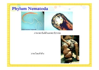 Phylum Nematoda




          ภาพ พยาธิแส้มาและพยาธิปากขอ
                       ้




       ภาพ โรคเท้าช้าง
 