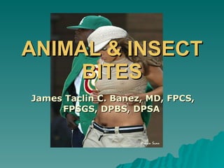 ANIMAL & INSECT BITES James Taclin C. Banez, MD, FPCS, FPSGS, DPBS, DPSA  