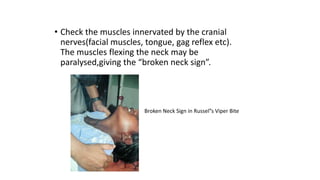 • Check the muscles innervated by the cranial
nerves(facial muscles, tongue, gag reflex etc).
The muscles flexing the neck may be
paralysed,giving the “broken neck sign”.
Broken Neck Sign in Russel”s Viper Bite
 