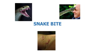 SNAKE BITE
 