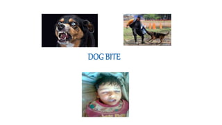 DOG BITE
 