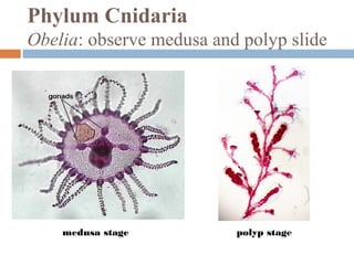 Phylum Cnidaria
Obelia: observe medusa and polyp slide

medusa stage

polyp stage

 