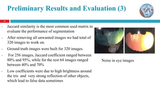 2121
Preliminary Results and Evaluation (3)
• Jaccard similarity is the most common used matrix to
evaluate the performance of segmentation
• After removing all unwanted images we had total of
320 images to work on.
• Ground truth images were built for 320 images.
• For 256 images, Jaccard coefficient ranged between
80% and 95%, while for the rest 64 images ranged
between 40% and 70%
• Low coefficients were due to high brightness around
the iris and very strong reflection of other objects,
which lead to false data sometimes
Noise in eye images
 