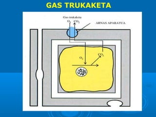 GAS TRUKAKETA

 
