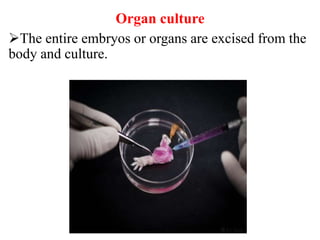 The entire embryos or organs are excised from the
body and culture.
Organ culture
 