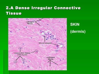 2.A Dense Irregular Connective Tissue SKIN  (dermis) 