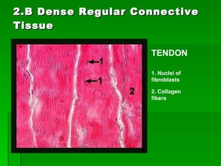 2.B Dense Regular Connective Tissue 1. Nuclei of fibroblasts   2. Collagen fibers   TENDON 