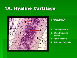 1A. Hyaline Cartilage Cartilage matrix Chondrocyte in lacuna Perichondrium Adipose (Fat) cells TRACHEA 