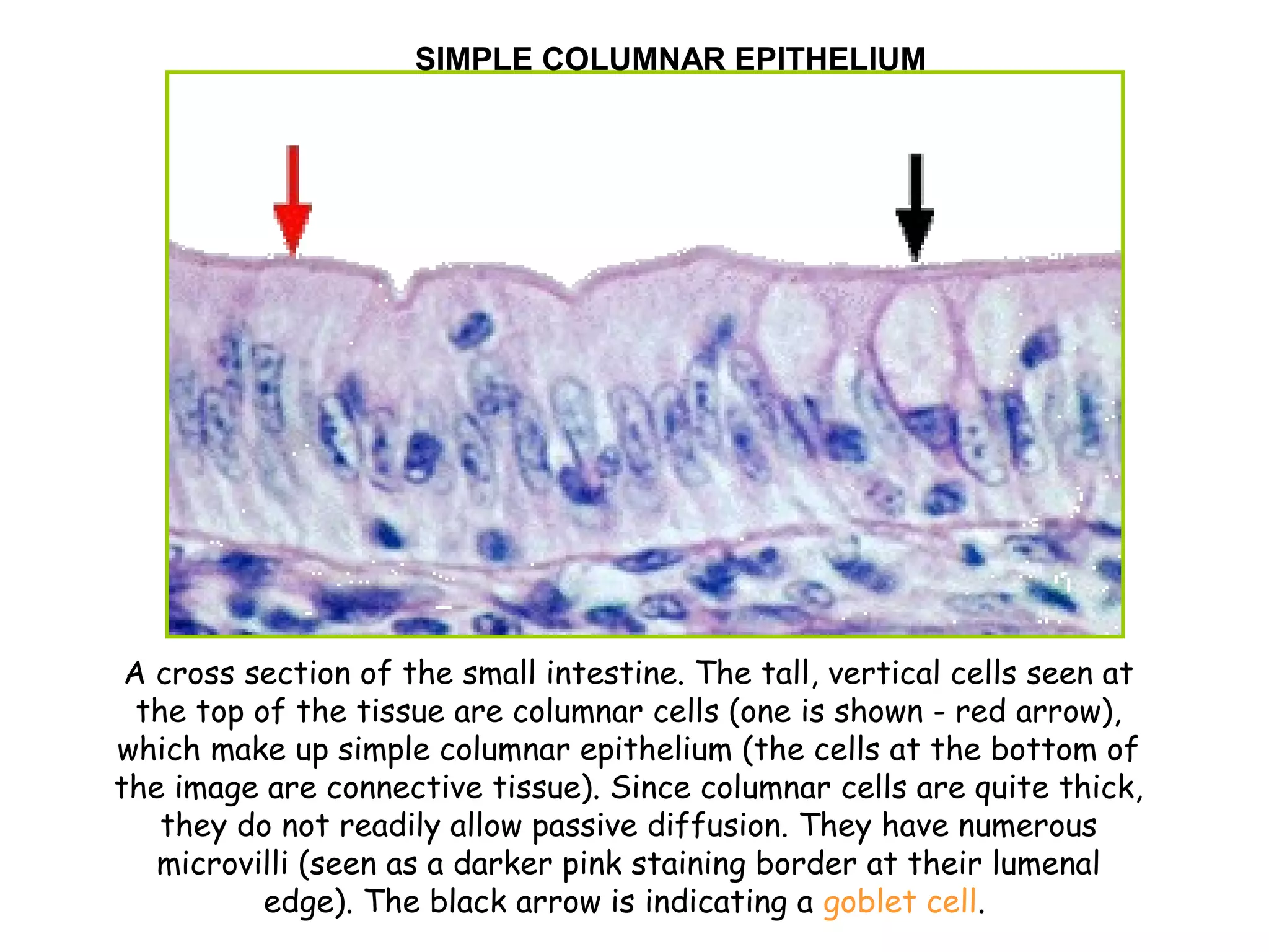 A cross section of the small intestine. The tall, vertical cells seen at
the top of the tissue are columnar cells (one is shown - red arrow),
which make up simple columnar epithelium (the cells at the bottom of
the image are connective tissue). Since columnar cells are quite thick,
they do not readily allow passive diffusion. They have numerous
microvilli (seen as a darker pink staining border at their lumenal
edge). The black arrow is indicating a goblet cell.
SIMPLE COLUMNAR EPITHELIUM
 