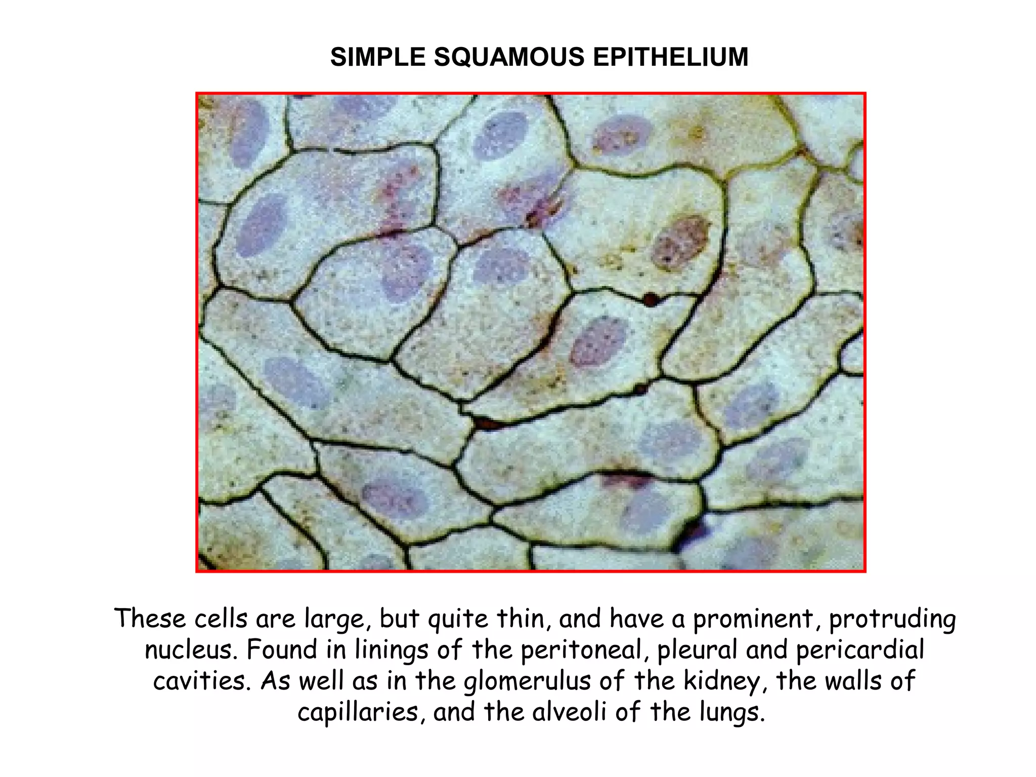 These cells are large, but quite thin, and have a prominent, protruding
nucleus. Found in linings of the peritoneal, pleural and pericardial
cavities. As well as in the glomerulus of the kidney, the walls of
capillaries, and the alveoli of the lungs.
SIMPLE SQUAMOUS EPITHELIUM
 