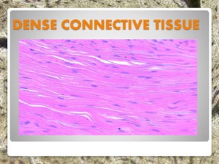 DENSE CONNECTIVE TISSUE
 