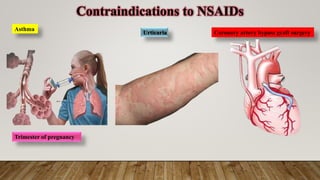 animated presentation on NSIDs.pptx