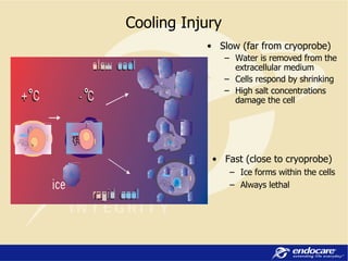 Cooling Injury Fast (close to cryoprobe) Ice forms within the cells Always lethal Slow (far from cryoprobe) Water is removed from the extracellular medium Cells respond by shrinking High salt concentrations damage the cell 