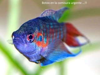 Botox en la comisura urgente …!! 