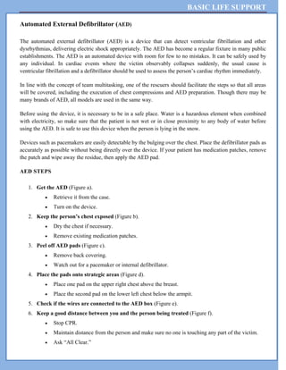 BASIC LIFE SUPPORT
Automated External Defibrillator (AED)
The automated external defibrillator (AED) is a device that can detect ventricular fibrillation and other
dysrhythmias, delivering electric shock appropriately. The AED has become a regular fixture in many public
establishments. The AED is an automated device with room for few to no mistakes. It can be safely used by
any individual. In cardiac events where the victim observably collapses suddenly, the usual cause is
ventricular fibrillation and a defibrillator should be used to assess the person’s cardiac rhythm immediately.
In line with the concept of team multitasking, one of the rescuers should facilitate the steps so that all areas
will be covered, including the execution of chest compressions and AED preparation. Though there may be
many brands of AED, all models are used in the same way.
Before using the device, it is necessary to be in a safe place. Water is a hazardous element when combined
with electricity, so make sure that the patient is not wet or in close proximity to any body of water before
using the AED. It is safe to use this device when the person is lying in the snow.
Devices such as pacemakers are easily detectable by the bulging over the chest. Place the defibrillator pads as
accurately as possible without being directly over the device. If your patient has medication patches, remove
the patch and wipe away the residue, then apply the AED pad.
AED STEPS
1. Get the AED (Figure a).
 Retrieve it from the case.
 Turn on the device.
2. Keep the person’s chest exposed (Figure b).
 Dry the chest if necessary.
 Remove existing medication patches.
3. Peel off AED pads (Figure c).
 Remove back covering.
 Watch out for a pacemaker or internal defibrillator.
4. Place the pads onto strategic areas (Figure d).
 Place one pad on the upper right chest above the breast.
 Place the second pad on the lower left chest below the armpit.
5. Check if the wires are connected to the AED box (Figure e).
6. Keep a good distance between you and the person being treated (Figure f).
 Stop CPR.
 Maintain distance from the person and make sure no one is touching any part of the victim.
 Ask “All Clear.”
 